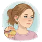 Otitis media with effusion